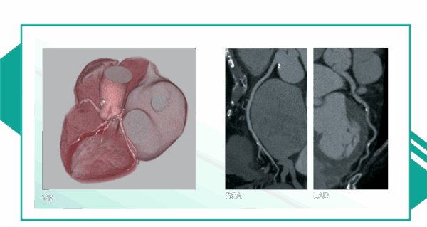Cardiac CT image 9