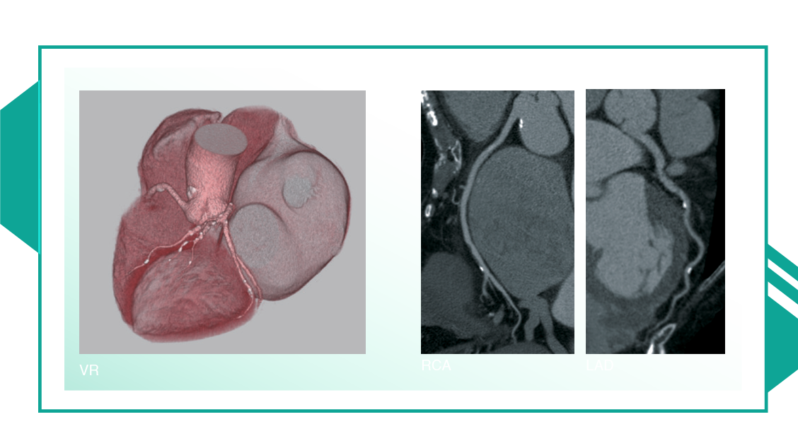 Cardiac CT image 10