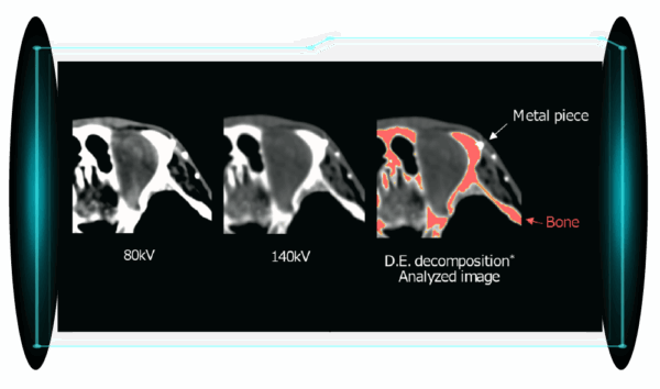 Cardiac CT image 11