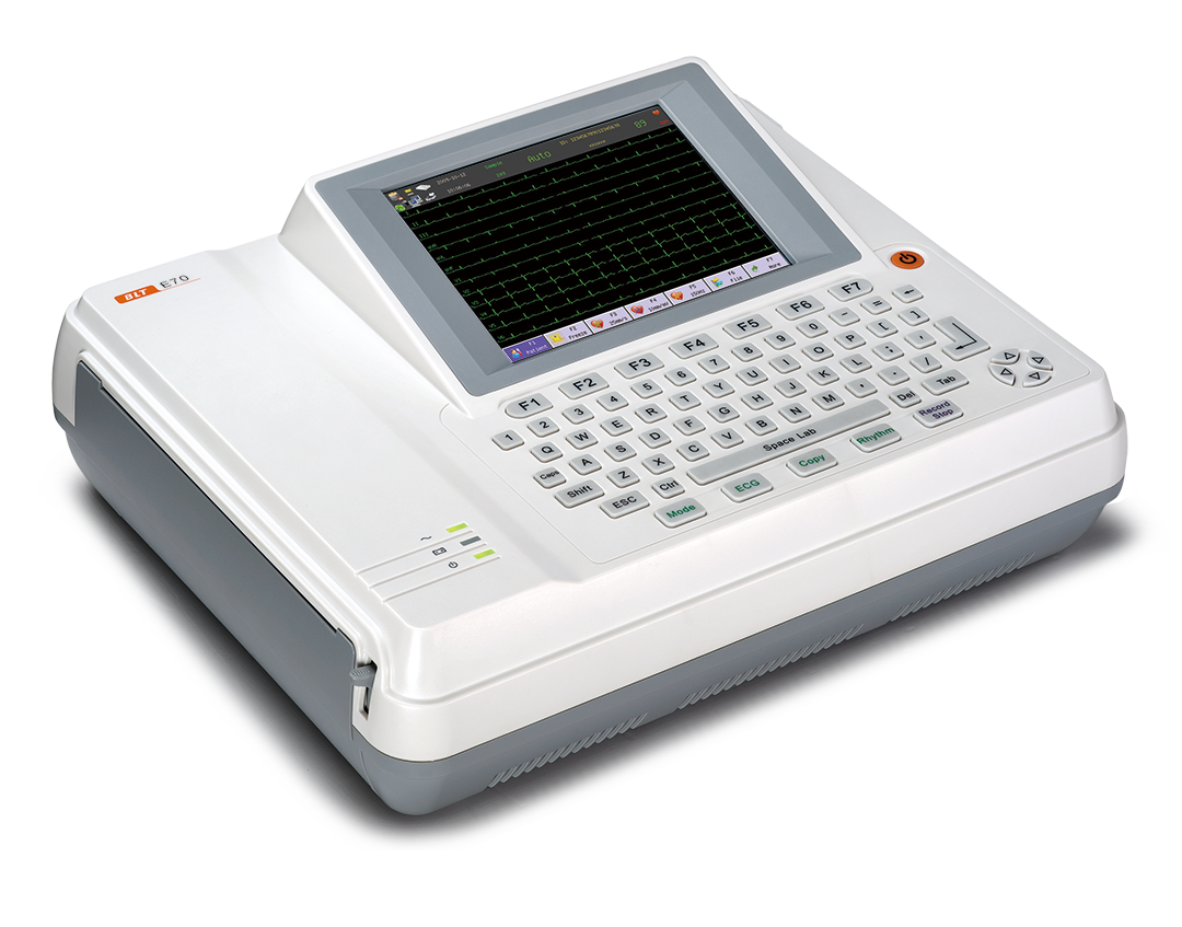 ECG image 4