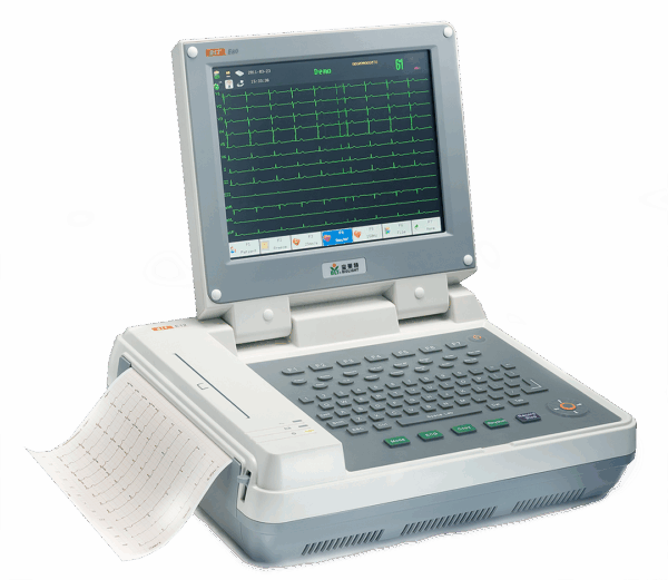 ECG image 7