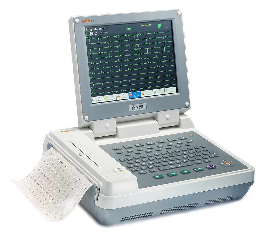 ECG image 8