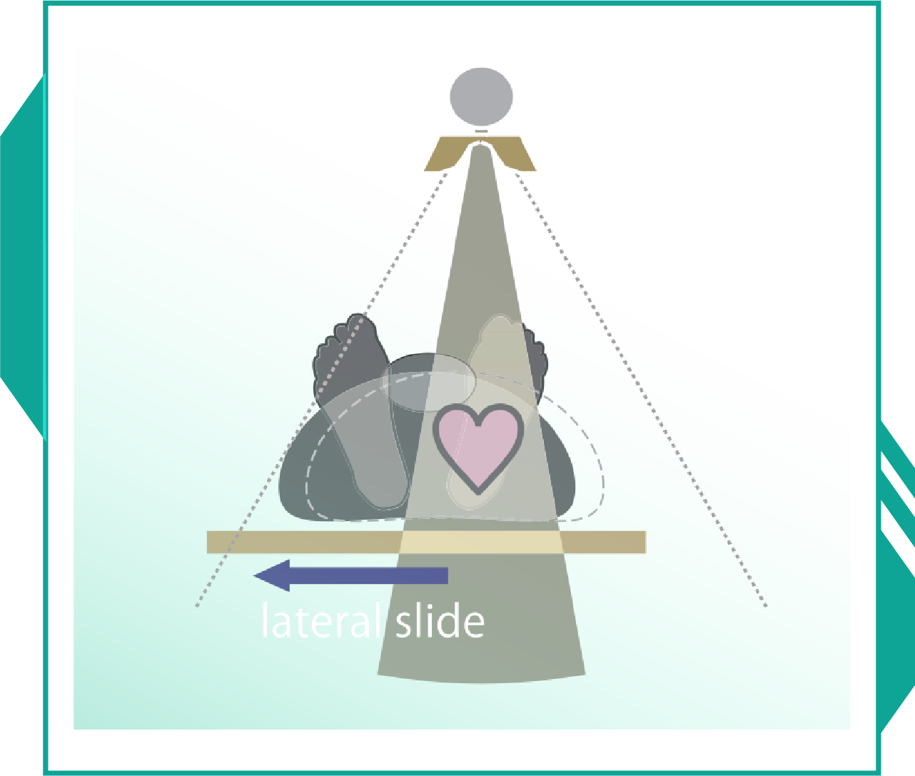 Cardiac CT image 16