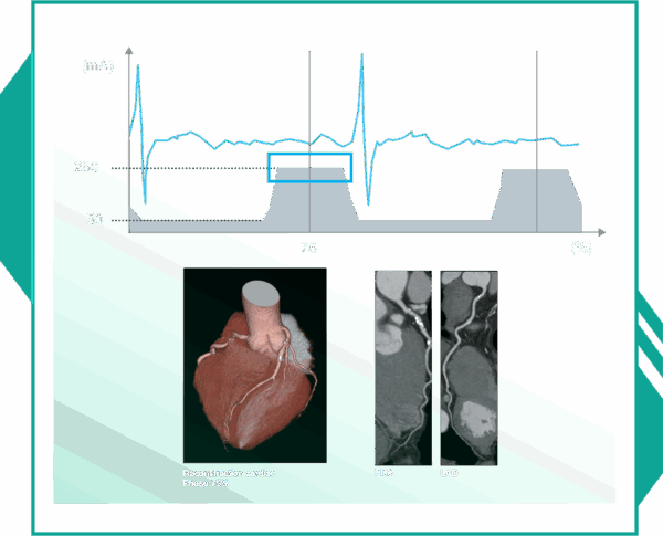 Cardiac CT image 17