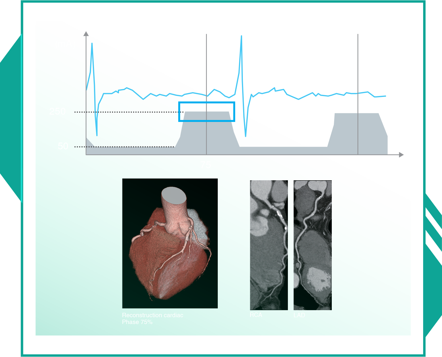 Cardiac CT image 18
