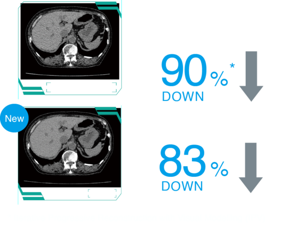 Cardiac CT image 3