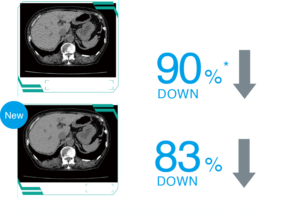 Cardiac CT image 4