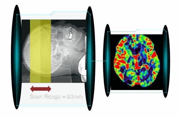 Cardiac CT image 7