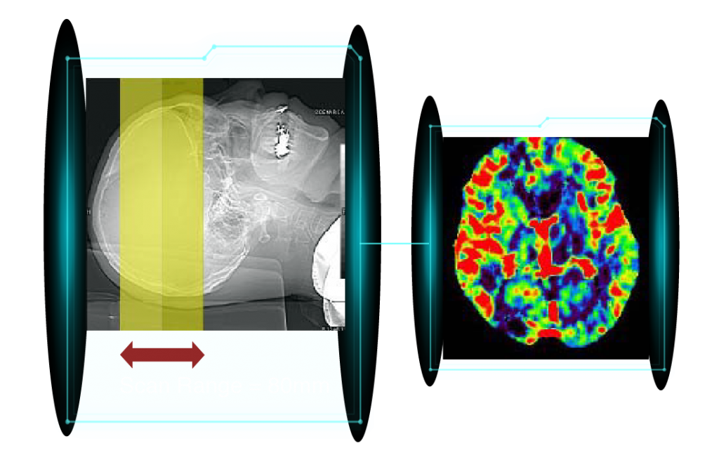 Cardiac CT image 8