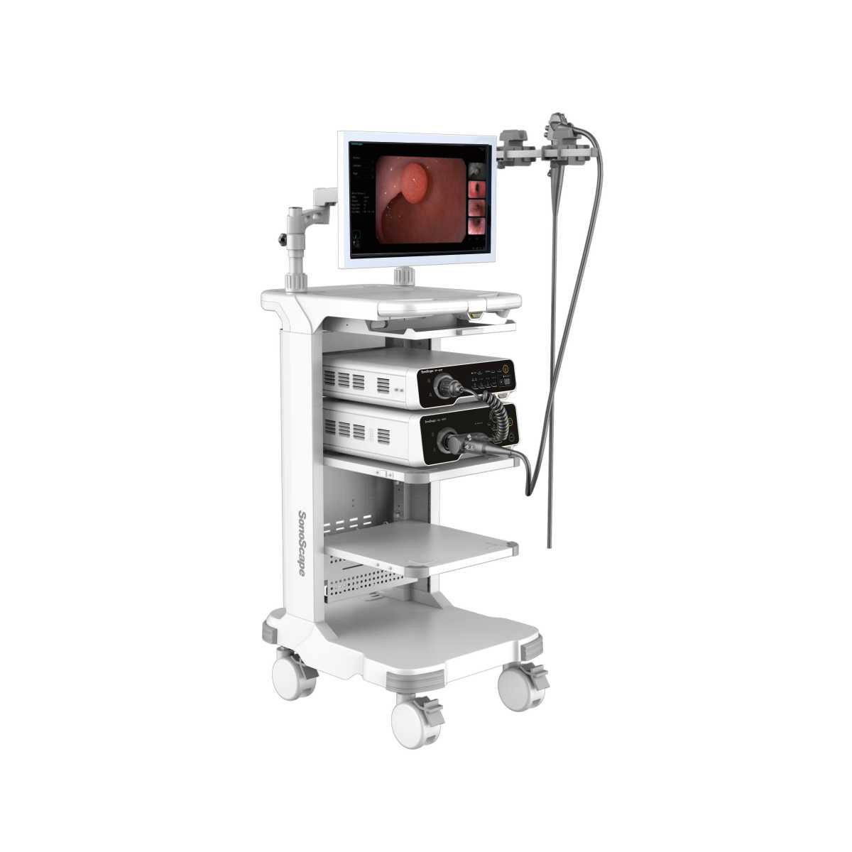 Endoscopy image 2