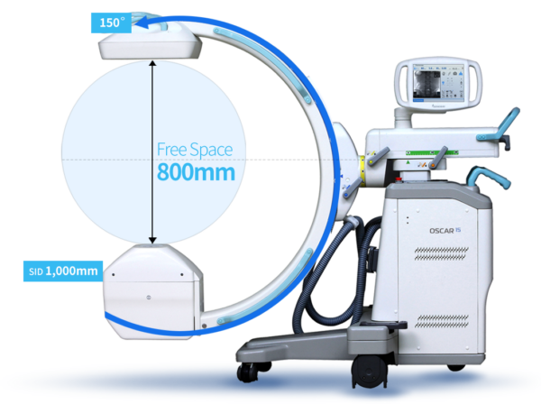 Mobile C-Arm (Genoray)
